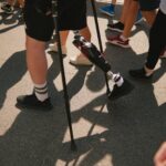 Person with prosthetic leg walking with crutches